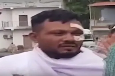 અમદાવાદમાં પ્લેન ક્રેશમાં એક માત્ર બચી ગયેલો વિશ્વાસ કૂમાર માનસિક બિમારીનો ભોગ બન્યો